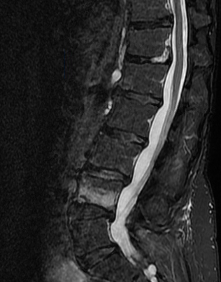 Spine – SoCal Neurosurgery